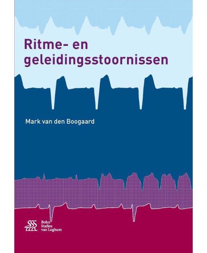 Ritme- en geleidingsstoornissen - Mark van den Boogaard