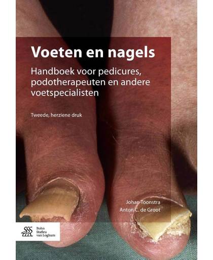 Voeten en nagels Nagelaandoeningen is de titel van de vorige editie isbn 9789031386185 - Johan Toonstra en Anton de Groot