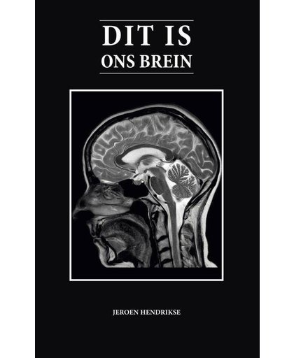 Dit is ons brein - Jeroen Hendrikse
