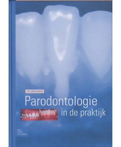 Parodontologie in de Praktijk - J.P. van Hoeve