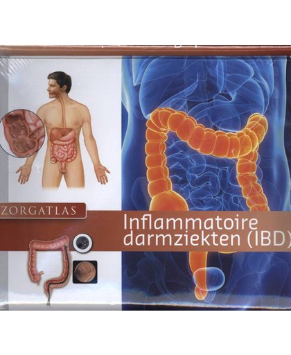 Zorgatlas Inflammatoire darmziekten (IBD) - Jeroen Jansen, Mirjam Traube, Karin Fienieg, e.a.