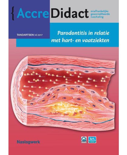 AccreDidact Parodontitis in relatie met hart- en vaatziekten - Bruno Loos
