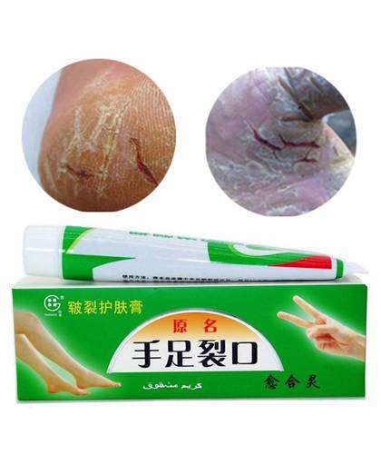 MyXL 2 Stks Hand Voet Crack Cream Hak Schrale Peeling Voet Hand reparatie Anti Droge Crack Huid Chinese Medicinale Zalf Crème Huid Care