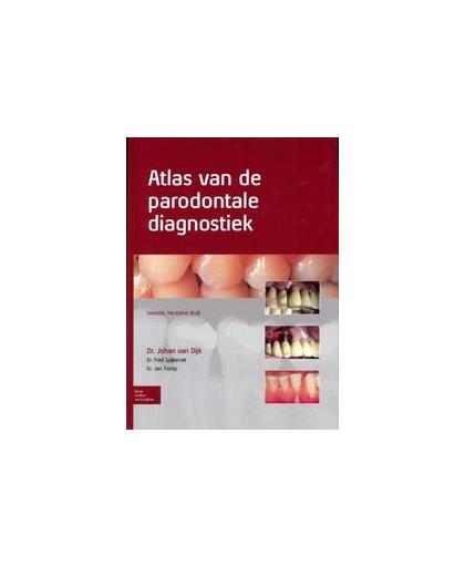 Atlas van de parodontale diagnostiek. Johan van Dijk, Hardcover