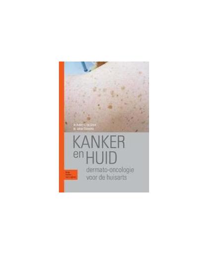 Kanker en huid. dermato-oncologie voor de huisarts, Toonstra, Johan, Paperback
