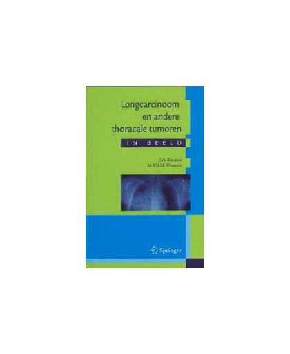 Longcarcinoom en andere thoracale tumoren: in beeld. Casuistiek in Een Breder Perspectief, M Wouters, Paperback
