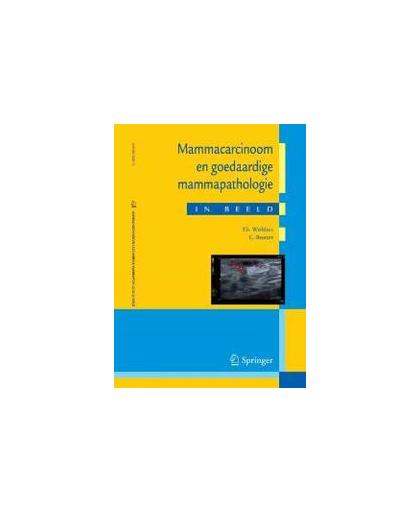 Mammacarcinoom en goedaardige mammapathologie in beeld. Casuïstiek in een breder perspectief, Wobbes, T., Paperback