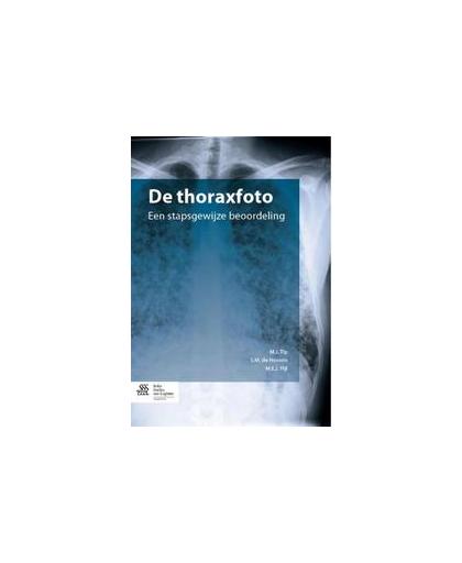 De thoraxfoto. een stapsgewijze beoordeling, Tip, M.J., Paperback
