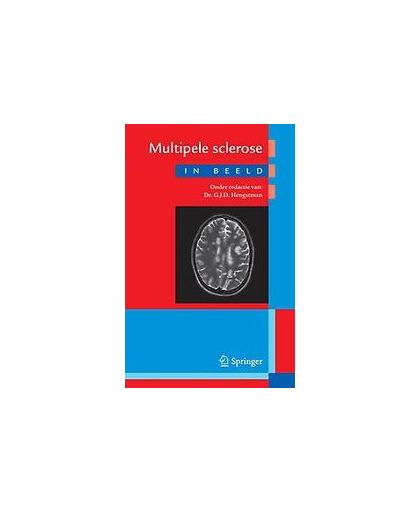 Multipele sclerose in beeld. HENGSTMAN G.J.D., Paperback