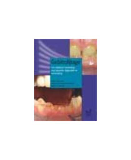 Gebitsslijtage. een praktische handreiking voor diagnostiek, preventie en behandeling, C. De Baat, Hardcover