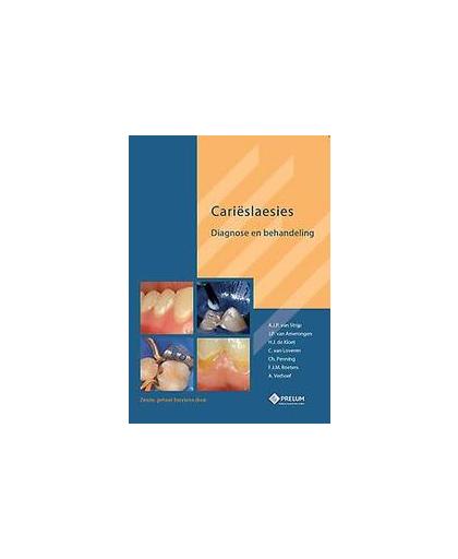Carieslaesies. diagnose en behandeling, Strijp, A.J.P. van, Hardcover