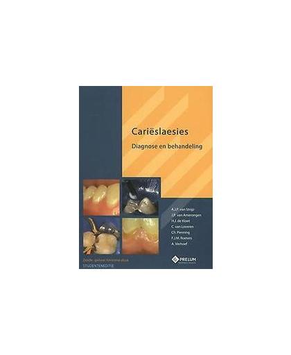 Carieslaesies-studenteneditie. diagnose en behandeling, Strijp, A.J.P. van, Paperback