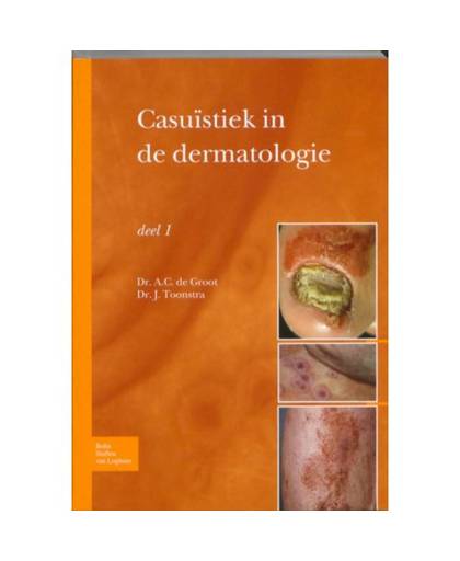 Casuïstiek in de dermatologie / deel 1