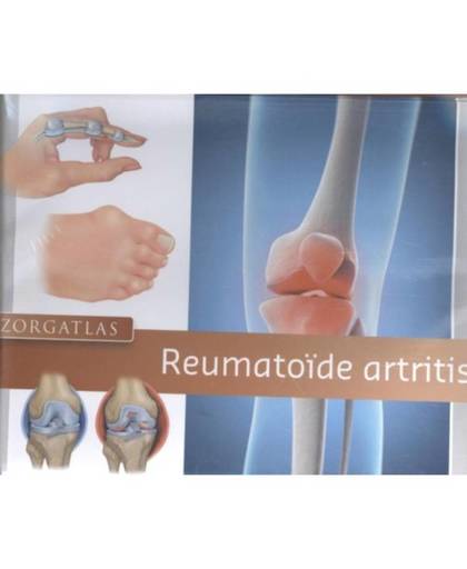 Zorgatlas Reumatoïde artritis