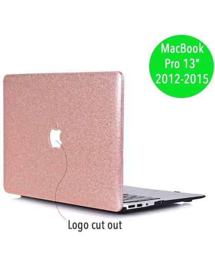 Lunso - glitter hardcase hoes - MacBook Pro Retina 13 inch (2012-2015) - roze