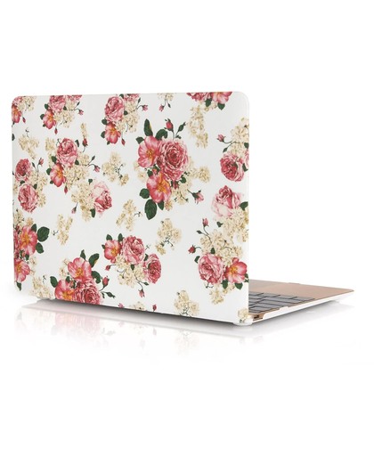 Xssive Macbook Case voor Macbook Air 11 inch - Laptoptas - Hard Case - Rozen