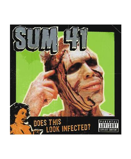 Sum 41 Does this look infected? CD st.
